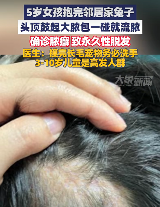 图片11